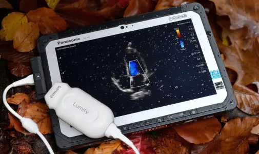 ultrasound apps for cell phones