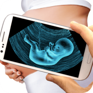 ultrasound on cell phone